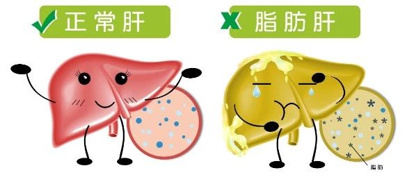 1750643895.jpg “减肥神药”司美格鲁肽再爆重磅消息:对脂肪肝有奇效 (2).jpg